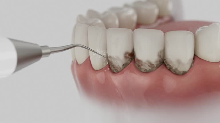 Reliable Dental contractor in University Heights, IA by Dentist Open Now